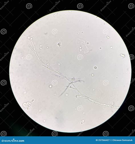 Microscopio che evidenzia batteri in un campione di urina