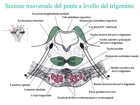 Sezione trasversale nucleo assorbente pannolone