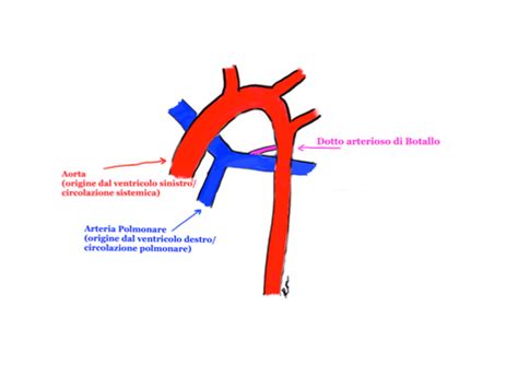 Dotto Arterioso di Botallo e Circolazione Polmonare Fetale
