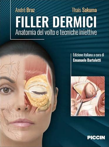 Diagramma che illustra l'applicazione di filler dermici