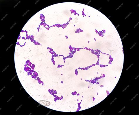 Candida al microscopio