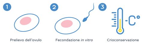 grafico che illustra le fasi del percorso di preservazione della fertilità nelle pazienti oncologiche