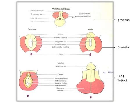 Diagram of male newborn genitalia showing foreskin