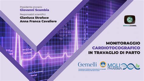 schema grafico del monitoraggio cardiotocografico in travaglio