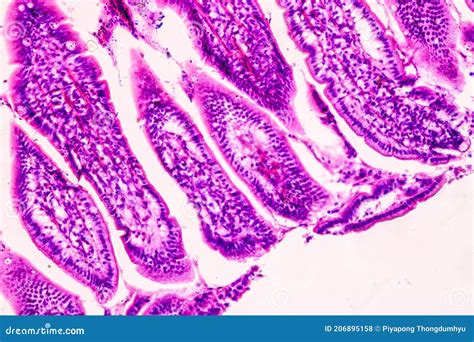 Microscopio su campione istologico