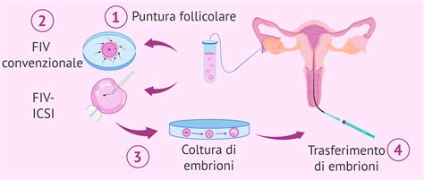 Schema che mostra il processo di Fecondazione In Vitro (FIVET)