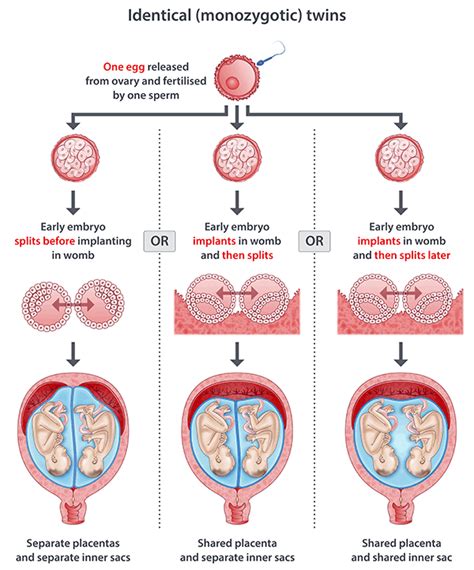 Illustration of fraternal twins arising from double ovulation