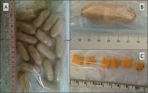 Differenza tra body packing e body stuffing