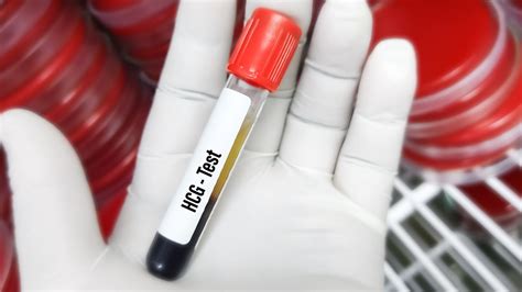 Provetta per test Beta-hCG