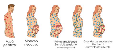 Profilassi anti-D in gravidanza