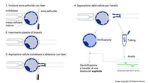Blastocisti pronta per la biopsia PGT