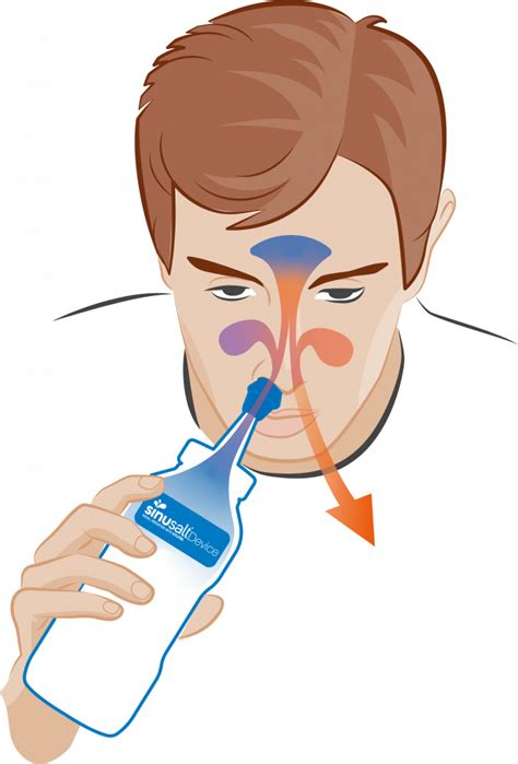 Nasal cleansing infographic