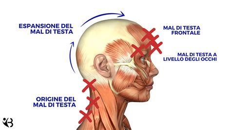 Rappresentazione dolore (mal di testa, mal di denti, dolori mestruali)