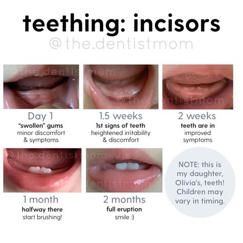 Graphic showing teething stages and symptoms