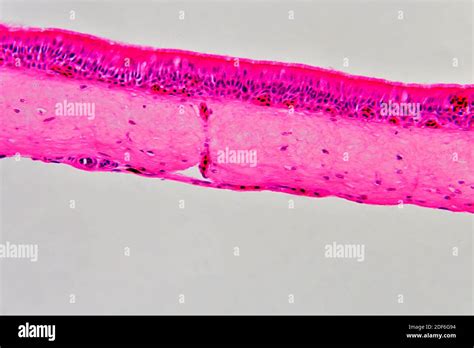 sezione trasversale dell'epitelio ciliato bronchiale