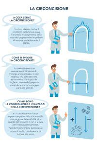 Diagramma che illustra la procedura di circoncisione