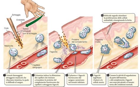 diagramma che mostra il processo infiammatorio delle vie aeree