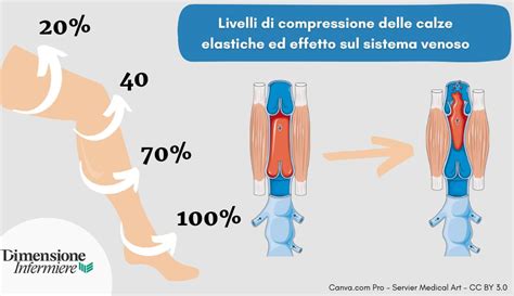 Infografica che illustra la pressione esercitata dalle calze elastiche a diversi livelli della gamba