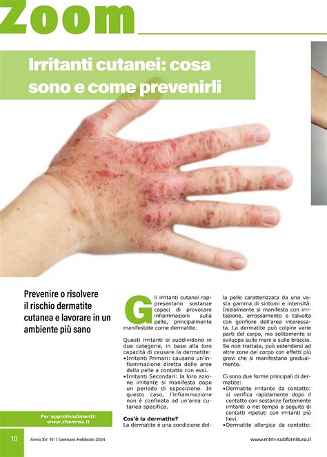 infografica sulle sostanze irritanti comuni come nichel, profumi e tessuti sintetici