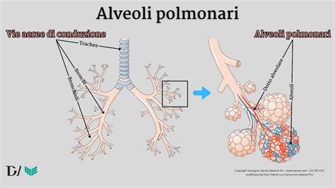 illustrazione schematica delle vie aeree di un neonato e come l'accumulo di muco possa ostruirle