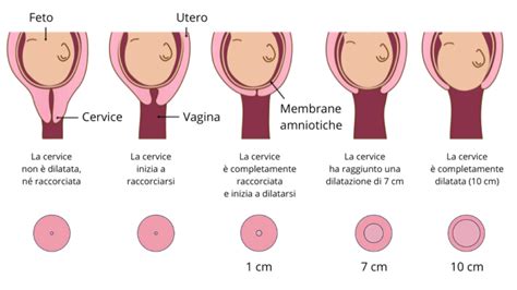 Infografica sulle fasi del parto e tipi di nascita