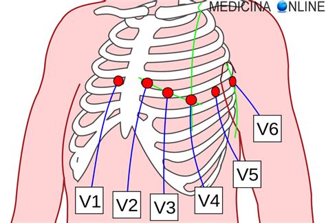 Disposizione elettrodi ECG materno e fetale sull'addome