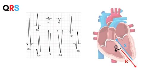 Complesso QRS in un segnale ECG con picco R evidenziato