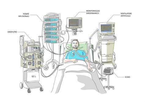 Paziente in terapia intensiva collegato a un ventilatore meccanico