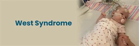 Opzioni terapeutiche per la Sindrome di West