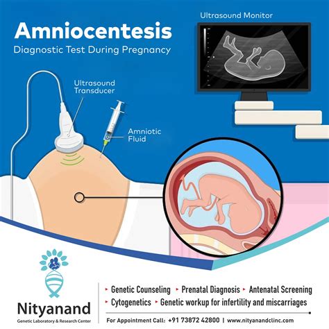 Villocentesis procedure diagram