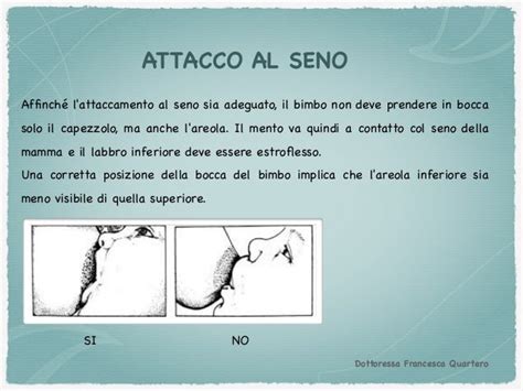 infografica sulla corretta posizione di attacco al seno