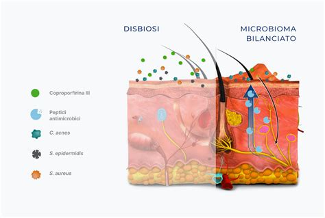 Microbioma della pelle infantile