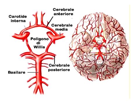 rappresentazione schematica della circolazione cerebrale fetale e potenziale ostruzione vascolare