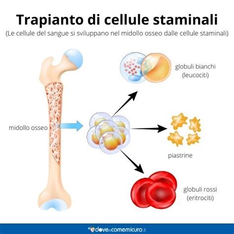 Diagramma che illustra il processo di trapianto di cellule staminali
