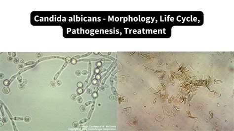 rappresentazione microscopica di Candida albicans
