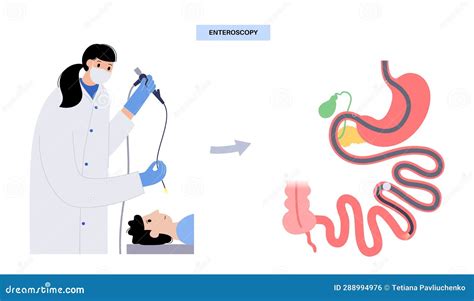 Illustrazione della procedura EXIT per teratoma cervicale