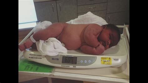 Historic image of the heaviest newborn baby in the world