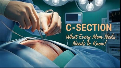 Obstetrician performing a C-section
