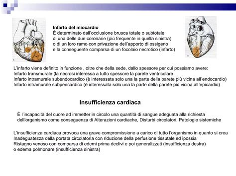 infografica che illustra le principali cause cardiache e sistemiche di aritmia ventricolare