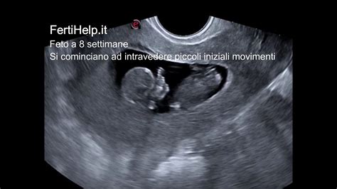 Ecografia di un feto che si muove nell'utero