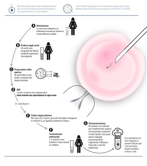 Tecnica di microiniezione ICSI