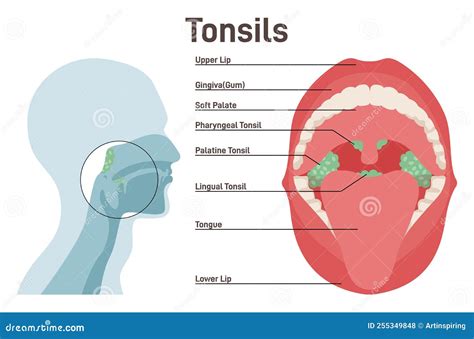 rappresentazione anatomica dell'anello linfatico di Waldeyer e delle tonsille nel cavo orale