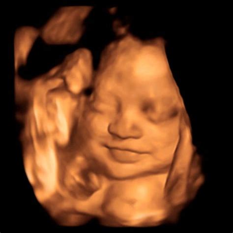 Ecografia 4D: Feto in movimento all'interno dell'utero