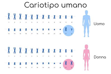 diagramma di un cariotipo umano con evidenza di anomalia cromosomica