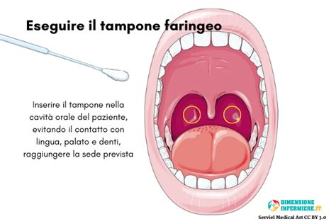 Diagramma procedura tampone faringeo