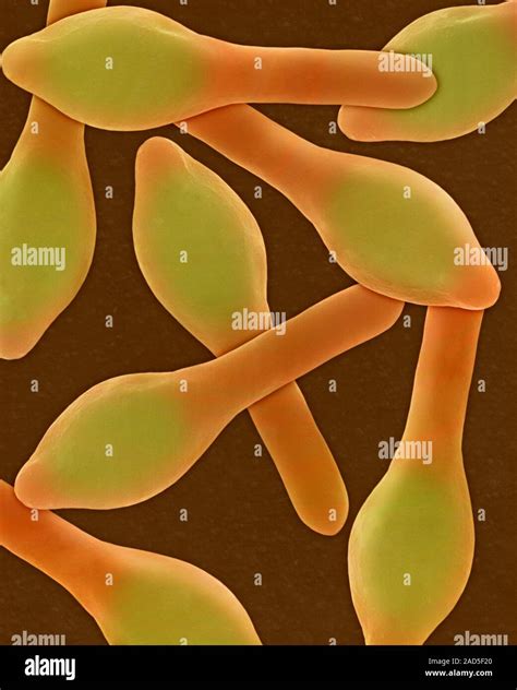 Clostridium botulinum spore