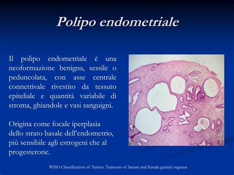 Diagramma che mostra un polipo peduncolato e un polipo sessile