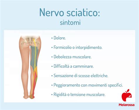 rappresentazione anatomica del nervo sciatico e del suo percorso dalla colonna vertebrale alle gambe