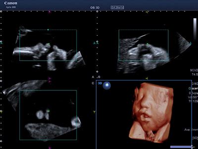 ecografia ostetrica di alto livello per il monitoraggio fetale