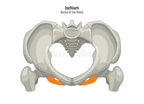 Diagramma illustrativo del funzionamento della tecnica Bulkamid nell'uretra femminile